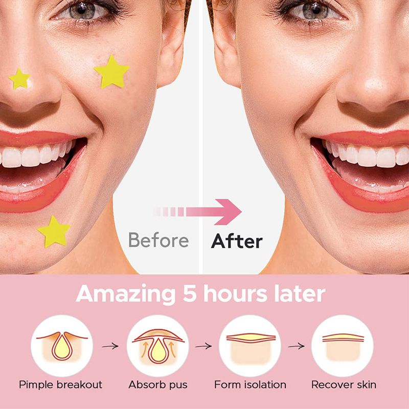600 ピース/セットスターにきびパッチにきびカラフルな目に - Beauty Of Makeup のレビューと価格